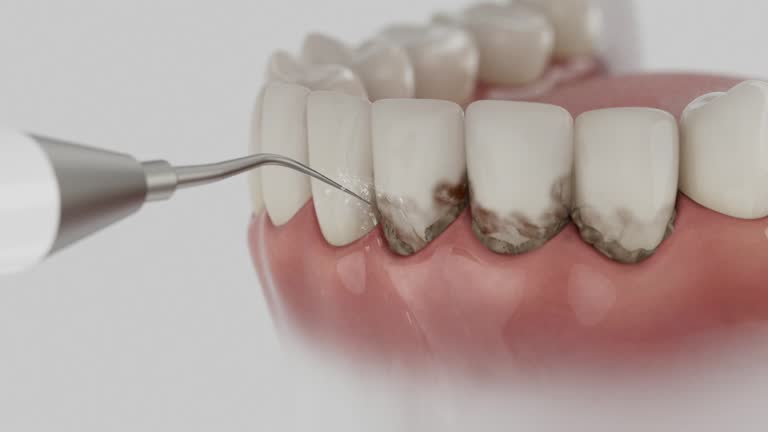 Reliable Emergency Dentist contractor in Monroeville, PA by Smile Center Dentistry